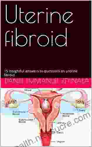 Uterine Fibroid: 15 Insightful Answers To Questions On Uterine Fibroid